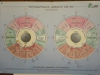 Irisdiagnostik